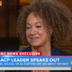 Rachel Dolezal
Today Show